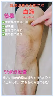 血流改善や女性特有のお悩みに「血海」